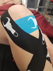 Pain from patella femoral arthritis